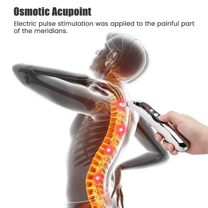 Acupuncture pen